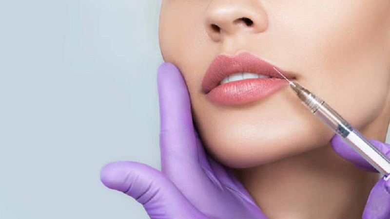 What Should You Know Before Considering Lip Enhancements?